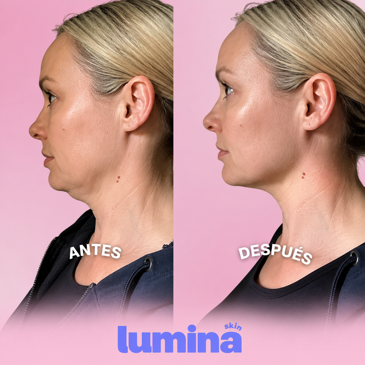 Cuello tonificado