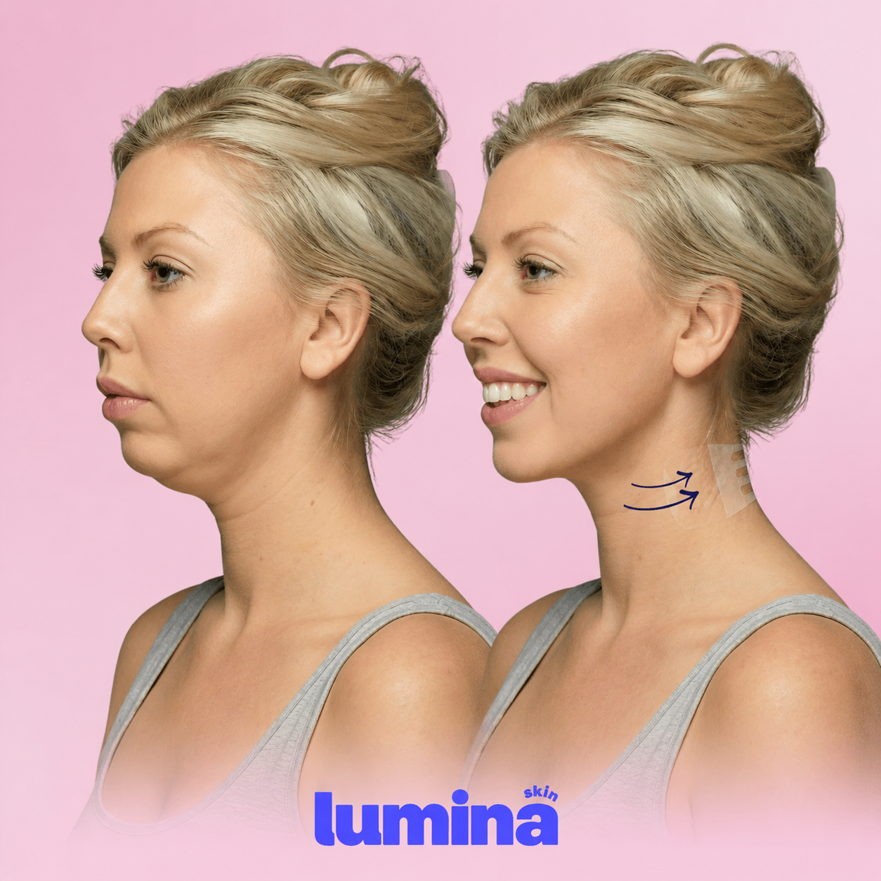 Cuello tonificado